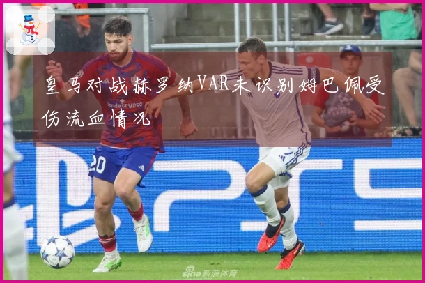 皇马对战赫罗纳VAR未识别姆巴佩受伤流血情况